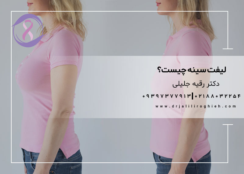 لیفت سینه چیست؟