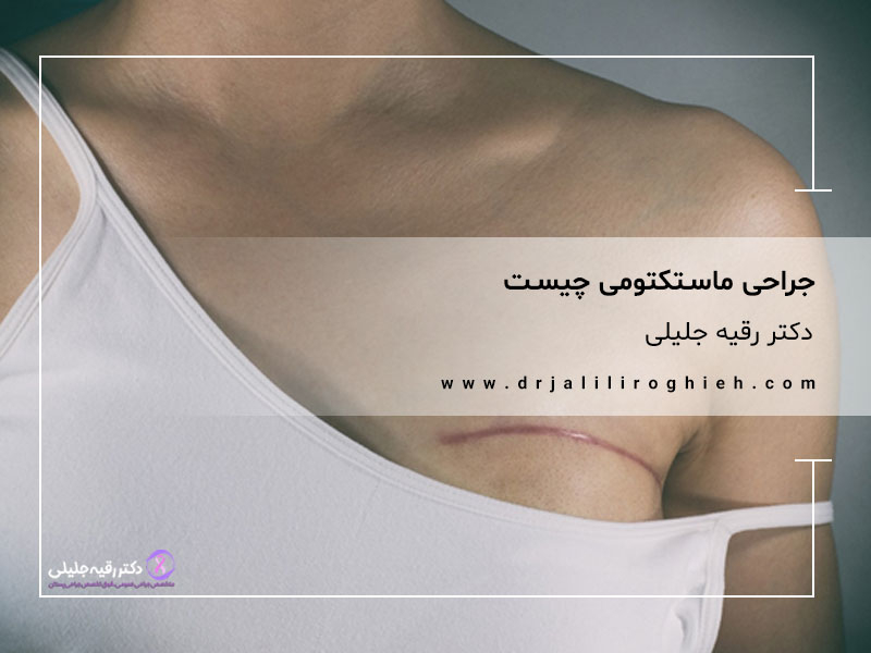 جراحی ماستکتومی چیست