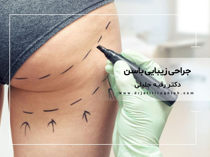 جراحی زیبایی باشن در تهران