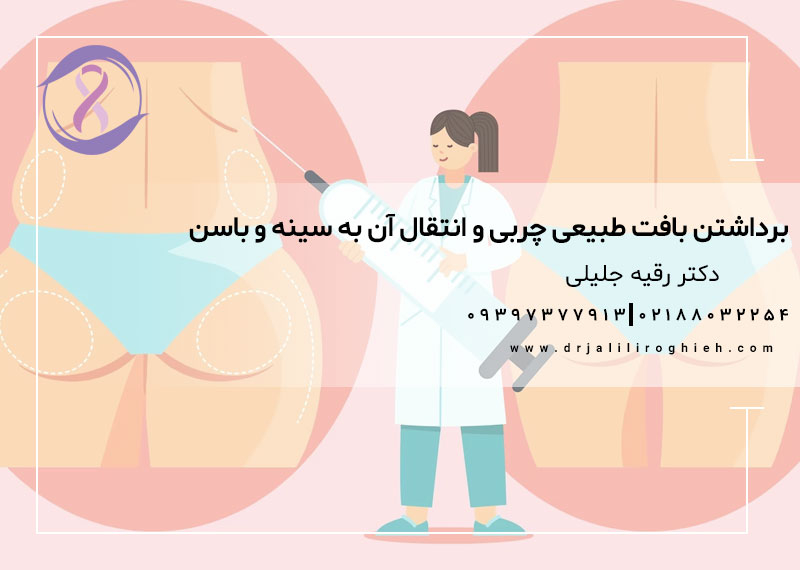 برداشتن بافت طبیعی چربی و انتقال آن به سینه و باسن