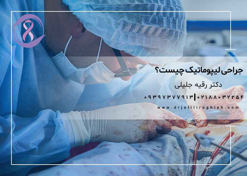 جراحی لیپوماتیک چیست؟