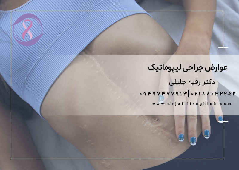عوارض جراحی لیپوماتیک