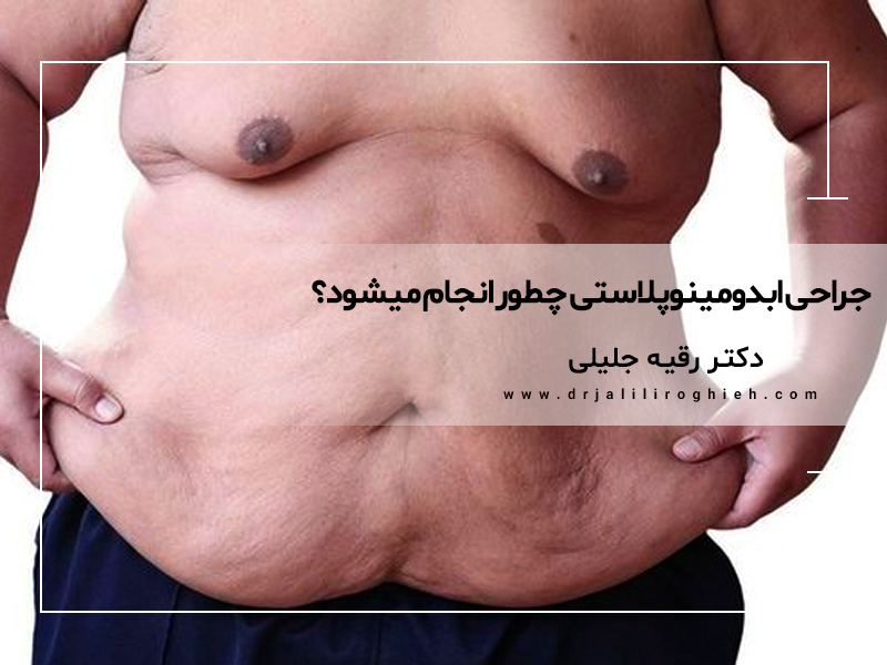 بهترین دکتر جراح ابدومینوپلاستی در تهران