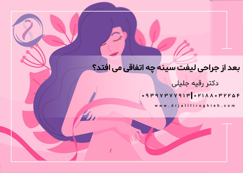 بعد از جراحی لیفت سینه چه اتفاقی می افتد؟