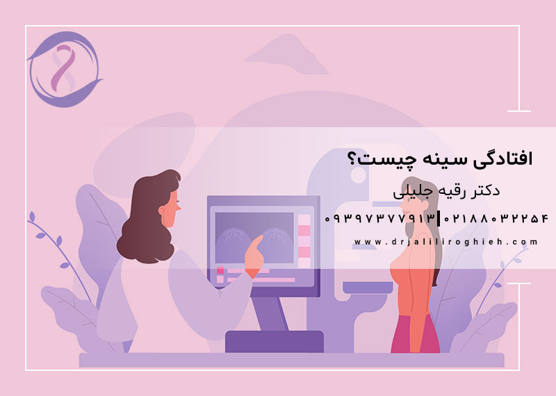 افتادگی سینه چیست