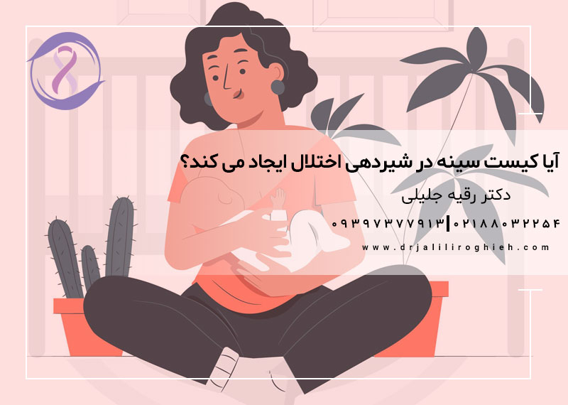 آیا کیست سینه در شیردهی اختلال ایجاد می کند؟