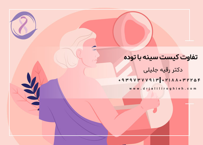 تفاوت کیست سینه با توده