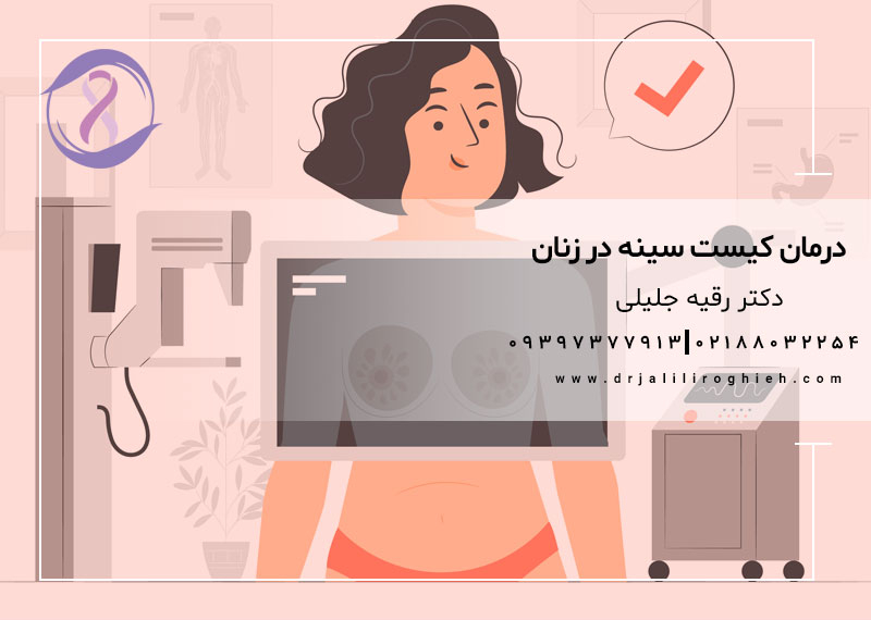 درمان کیست سینه در زنان