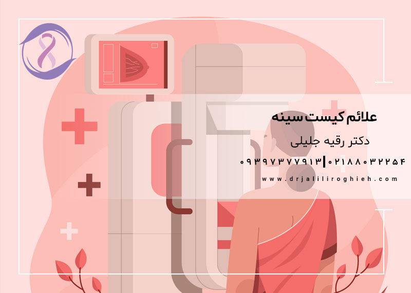 علائم کیست سینه