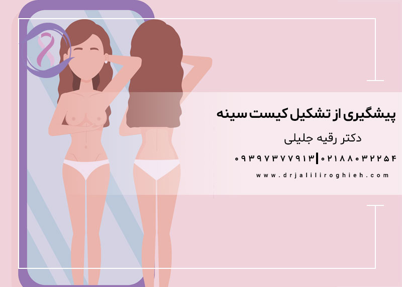 پیشگیری از تشکیل کیست سینه