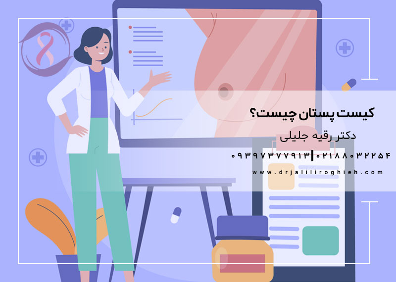 کیست پستان چیست؟