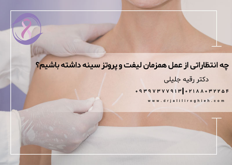 چه انتظاراتی از عمل همزمان لیفت و پروتز سینه داشته باشیم؟