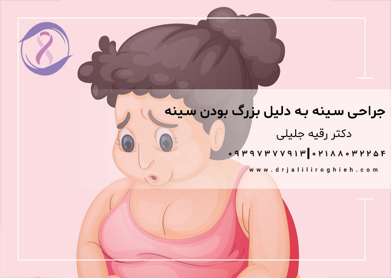 جراحی سینه به دلیل بزرگ بودن سینه