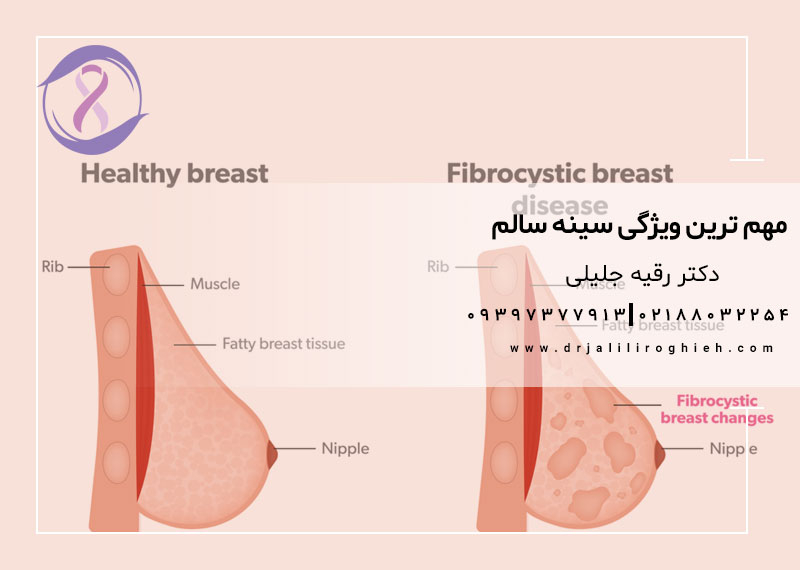 مهم ترین ویژگی سینه سالم