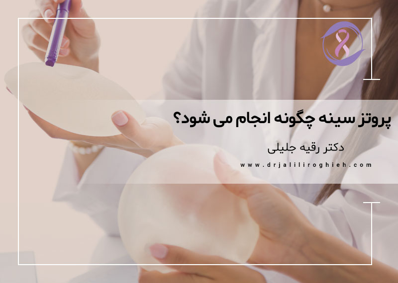 پروتز سینه چگونه انجام می شود؟