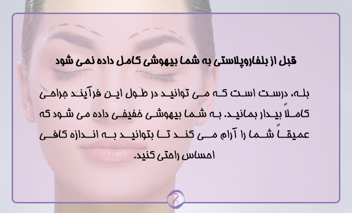نکات مهم بلفاروپلاستی