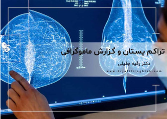 تراکم پستان و گزارش ماموگرافی شما