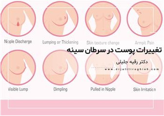 تغییرات پوست در سرطان سینه
