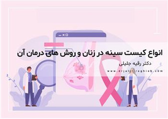 انواع کیست سینه در زنان و روش های درمان آن