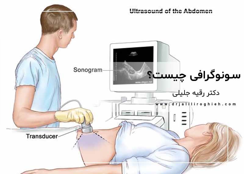 سونوگرافی چیست؟ هر آچه باید بدانید