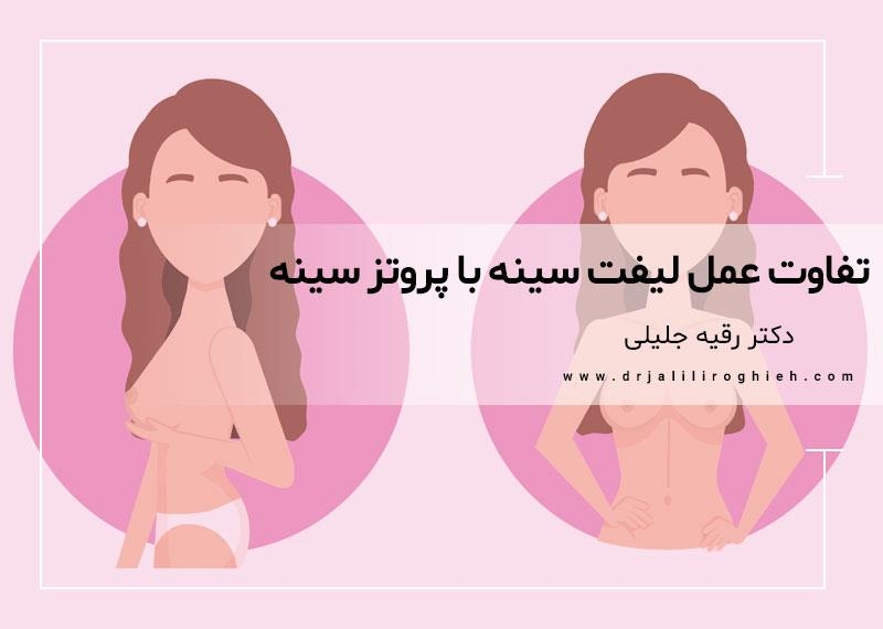 تفاوت عمل لیفت سینه با پروتز سینه