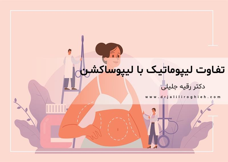 تفاوت لیپوماتیک با لیپوساکشن چیست؟ نگاه کلی به لیپوماتیک و لیپوساکشن