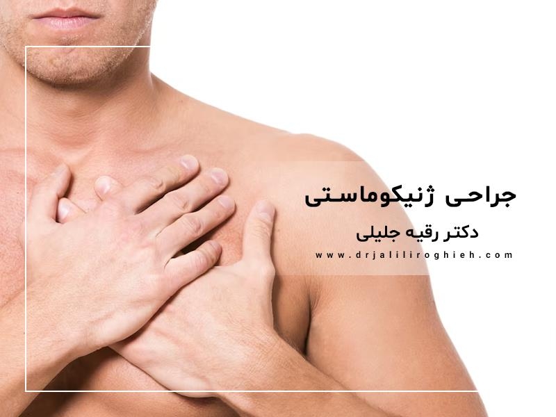 بهترین جراح ژنیکوماستی