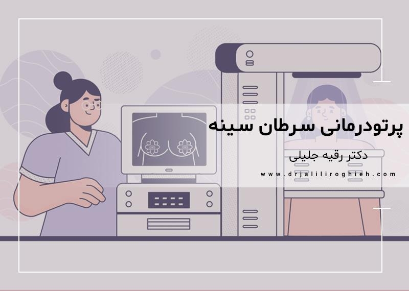 همه چیز درباره روش پرتودرمانی سرطان سینه