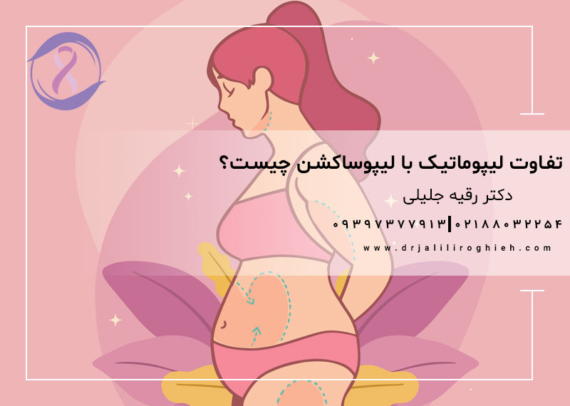 اینفوگرافی تفاوت‌ها