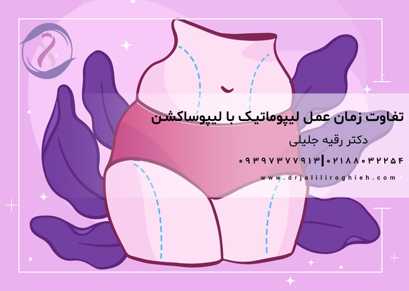 تفاوت زمان عمل