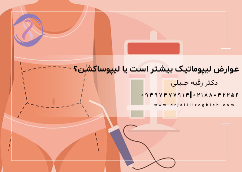 عوارض کدام بیشتر است؟