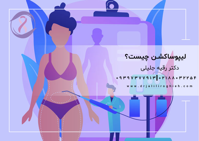 لیپوساکشن چیست