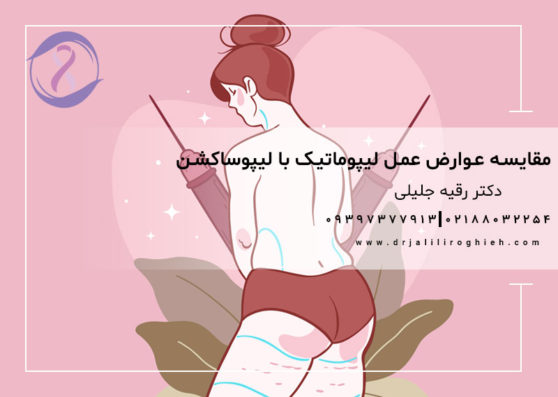 مقایسه عوارض