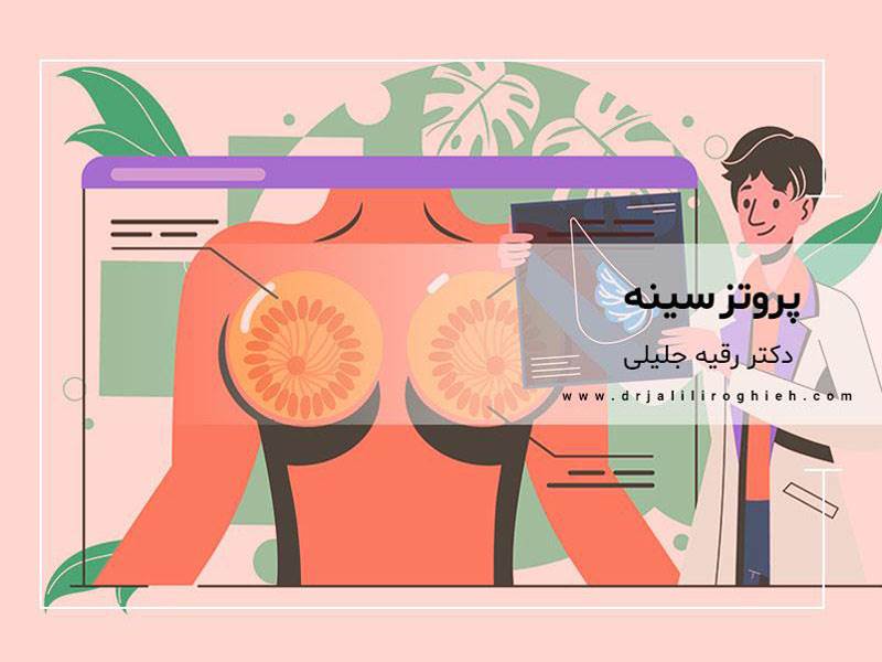 جراحی پروتز سینه در تهران