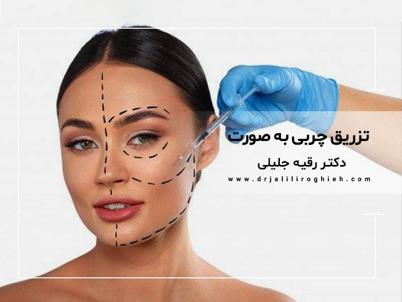 تزریق چربی به صورت در تهران