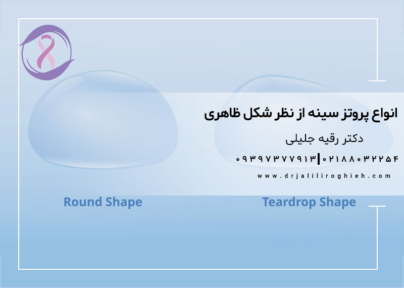 انواع پروتز سینه از نظر شکل ظاهری