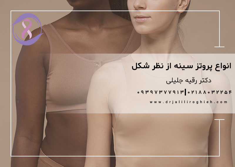 انواع پروتز سینه از نظر شکل