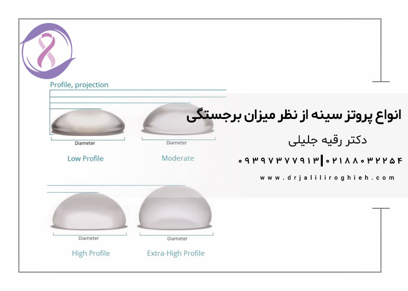 انواع پروتز سینه از نظر میزان برجستگی