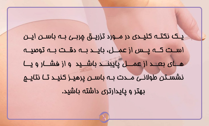 بعد از تزریق چربی از نشستن طولانی مدت روی باسن خودداری کنید
