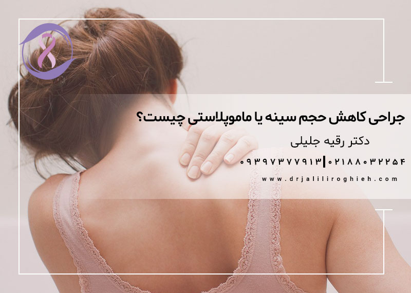 جراحی کاهش حجم سینه یا ماموپلاستی چیست؟