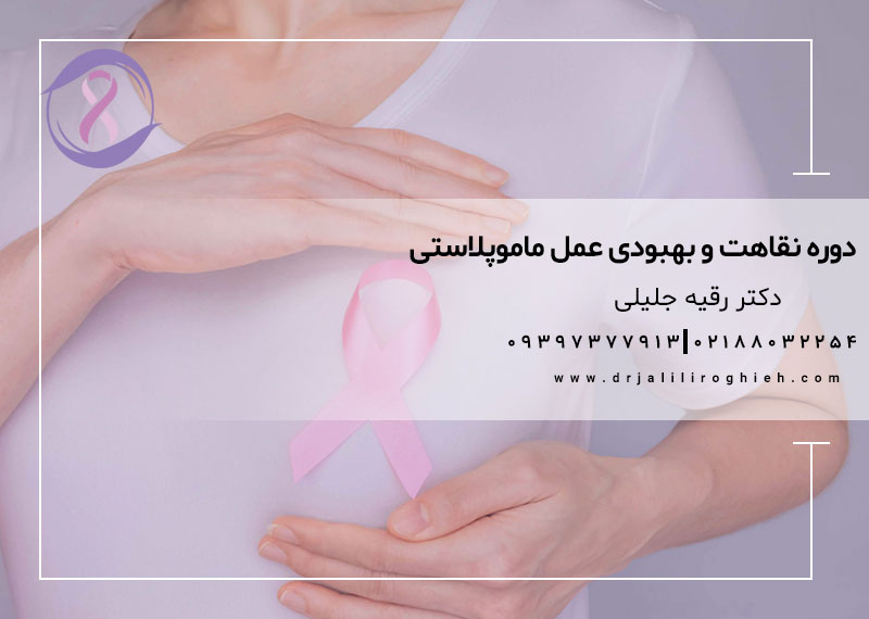 دوره نقاهت و بهبودی عمل ماموپلاستی