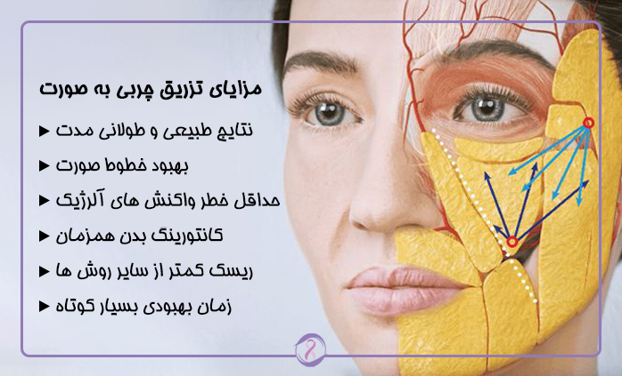 مزایای تزریق چربی به صورت