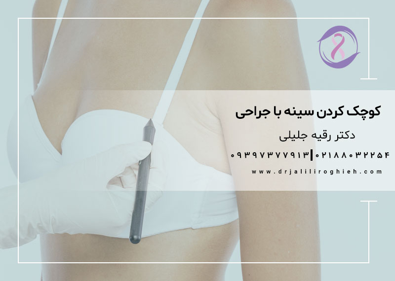 کوچک کردن سینه با جراحی